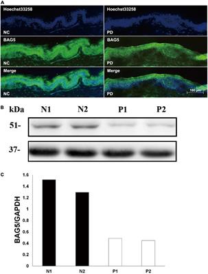 Identification of BAG5 as a Potential Biomarker for Parkinson’s Disease Patients With R492X PINK1 Mutation